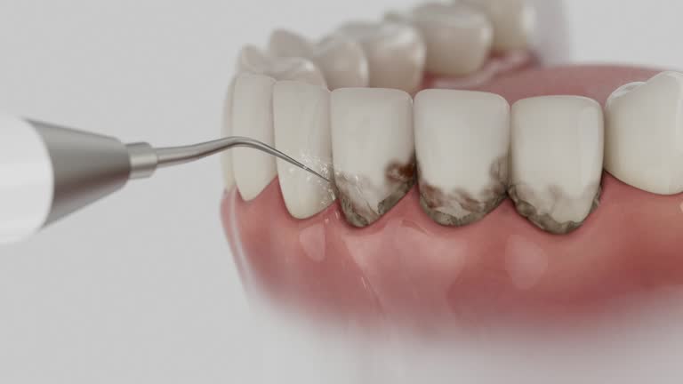 Trusted Emergency Dentist service in Parma, OH - Dentist Open Now